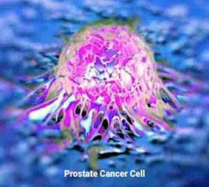 Prostate Cancer Cell
